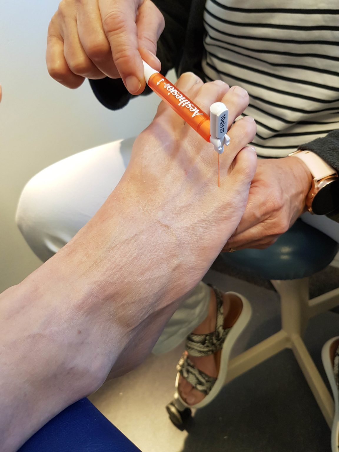 Diabetic Foot Care Marie Whitfield Podiatry Moorooka Podiatrist
